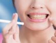 لمینت دندان برای افراد سیگاری