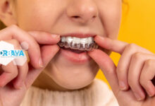 راهنمای کامل ارتودنسی دندان: مراحل، بهترین زمان و هزینه