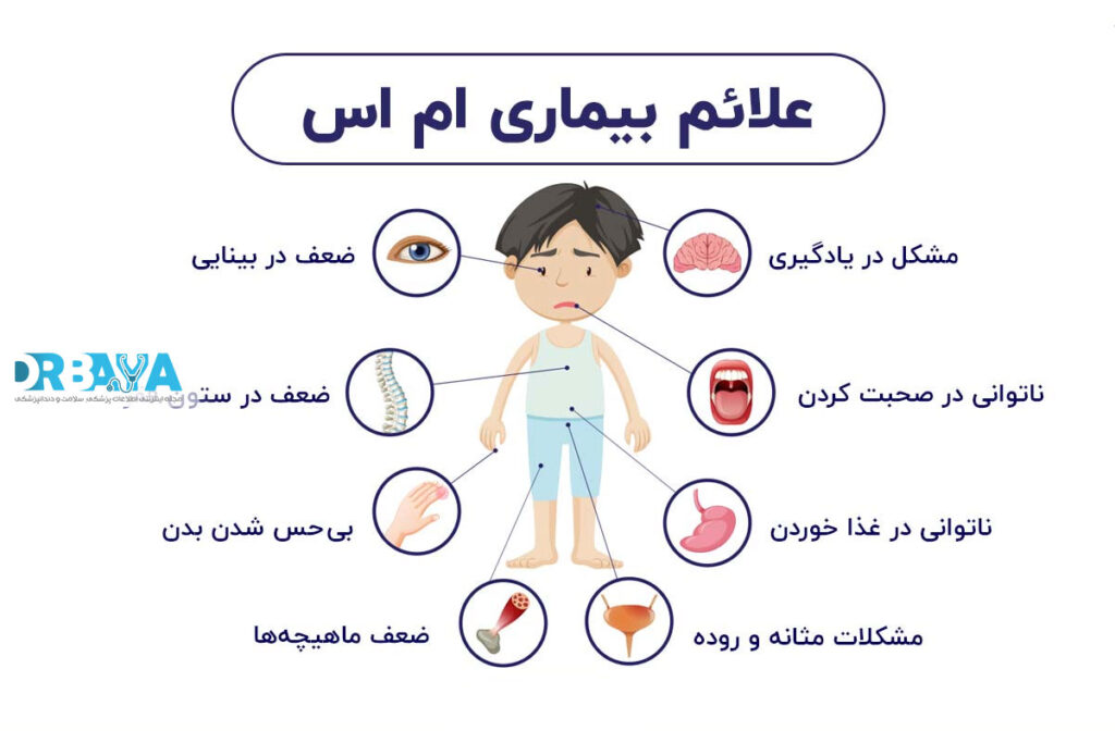 علائم ام اس